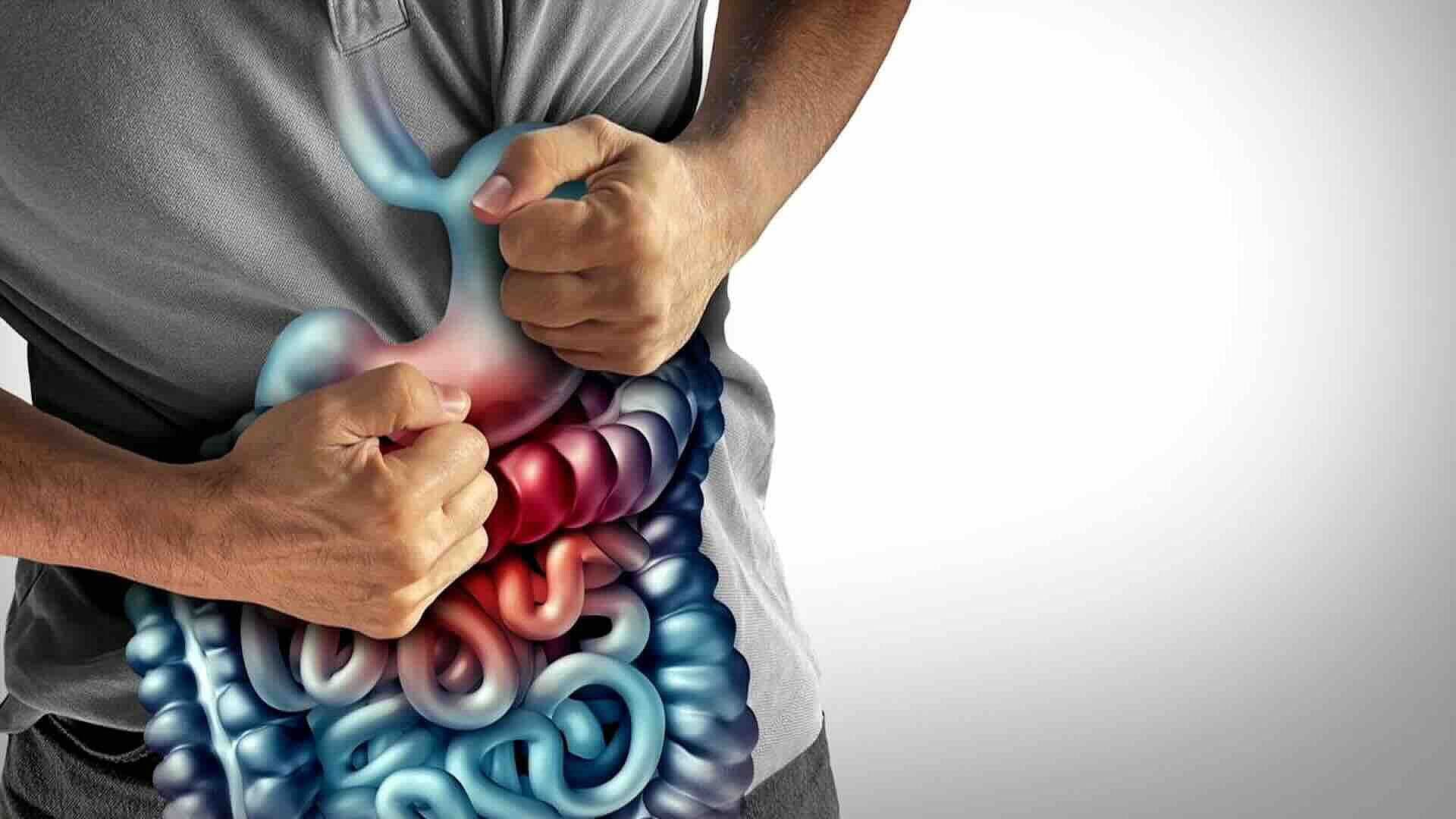 Colitis Ulcerosa: Conoce Síntomas, Tratamiento y Consecuencias