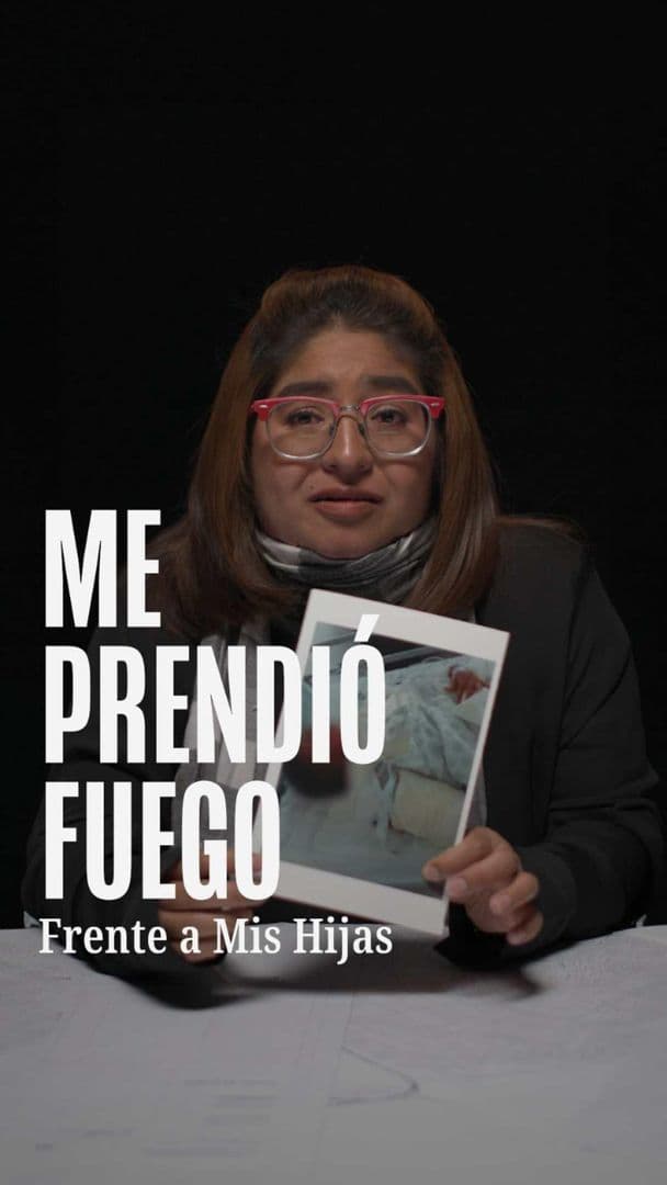 FOTO: Arely Escobar sobrevivió a intento de feminicidio de su expareja