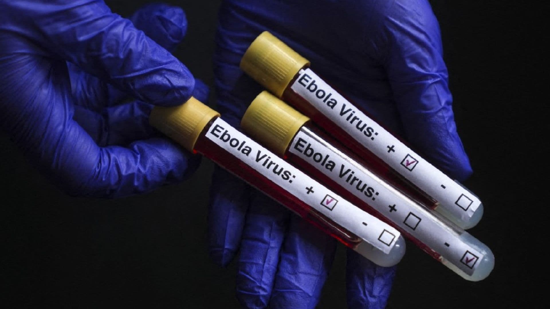 Brote de Ébola en Congo Supera los 900 Casos; Violencia Complica Atención Sanitaria