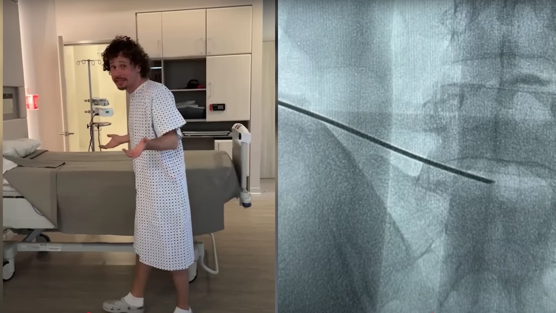 ¿Operaron a Luisito Comunica? 'Luisillo El Pillo' Dice Qué Pasó y el Problema de Salud que Tiene