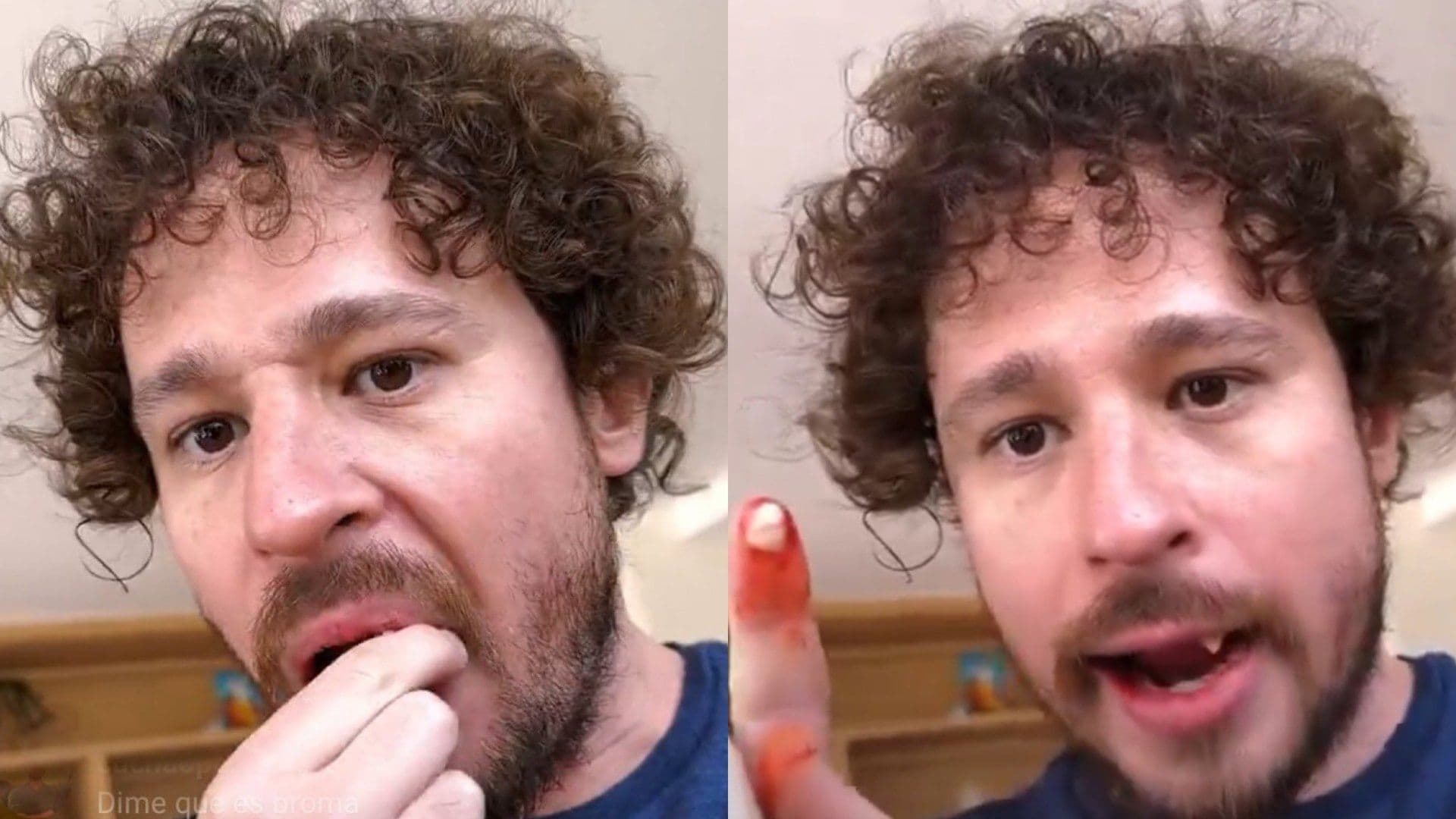 Se Le Caen los Dientes a Luisito Comunica en Vivo y los Memes No se Hacen Esperar