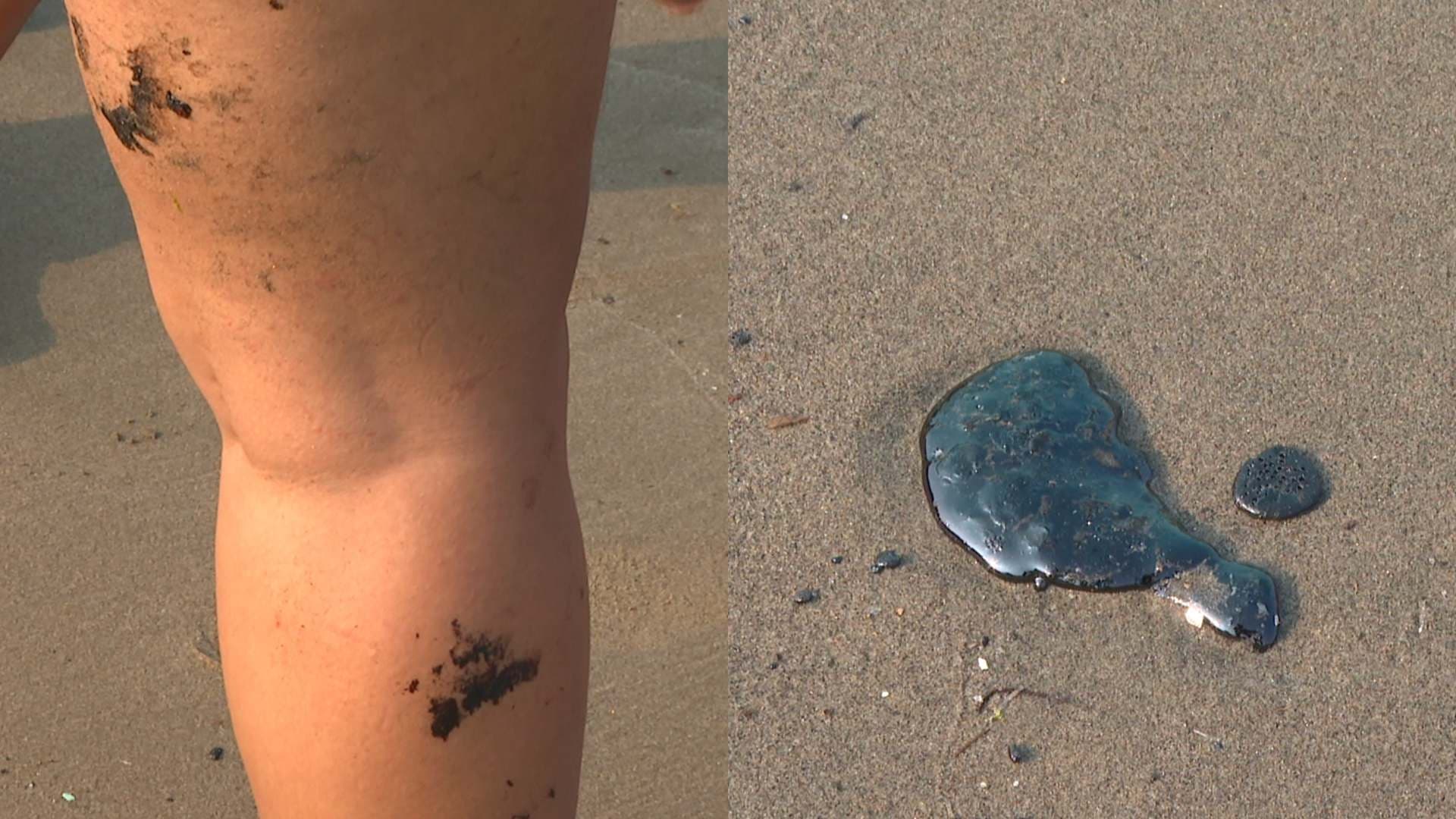Turistas Resultan con Manchas de Hidrocarburo en el Cuerpo al Visitar Playa en Veracruz